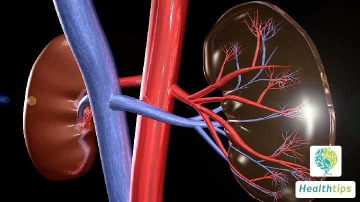 What Causes Acute Renal Failure?