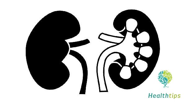 What Causes High Creatinine Levels with Normal Urinalysis Results?