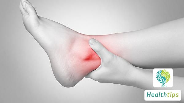 Will Walking Hurt if I Sprain My Ankle with Edema After Stepping off a Staircase?