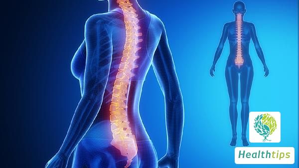 Where is the typical treatment for ankylosing spondylitis usually carried out?