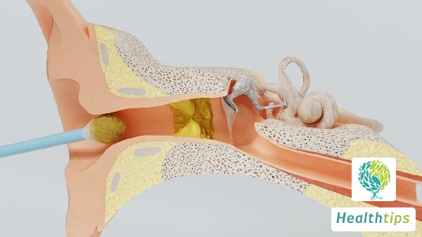 Can Tumors Develop in the Middle Ear, Including the Cochlea?