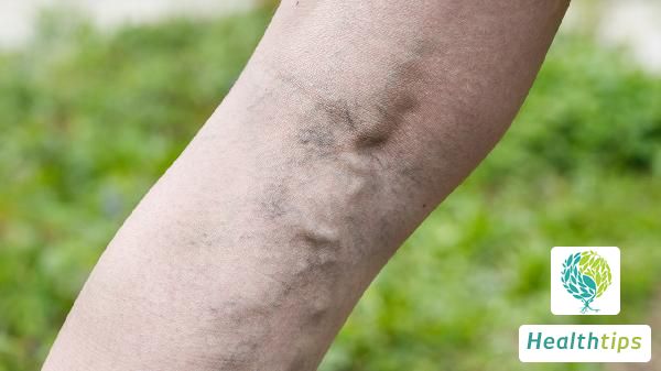 What Causes a Swollen Lump on the Arm Without Pain or Itching?