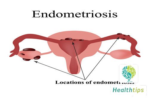 What Are the Symptoms of Malignant Tumors?