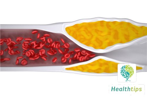 What Are the Causes of a Decreased Platelet Count?