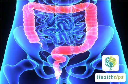 What Foods Should I Eat to Regulate Intestinal Inflammation?