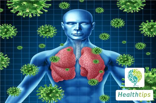 30 Herbal Remedies for Lung Squamous Cell Carcinoma: Explore the Ancient Secrets!