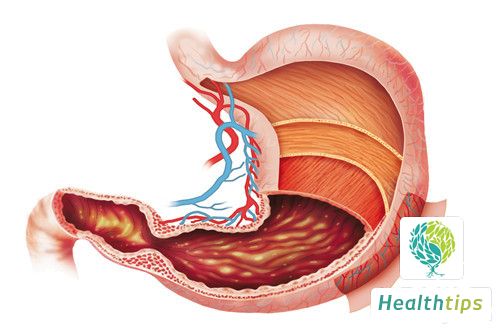 Can Gastric Diseases Be Detected Without Undergoing a Gastroscopy?