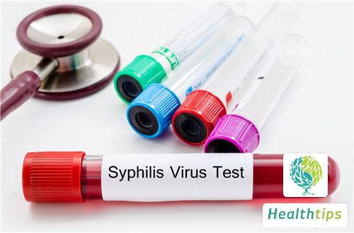 What Are the Differences Between Syphilis and HIV/AIDS?