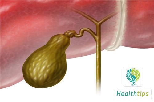 Can Bile Duct Stones Be Eliminated Naturally?