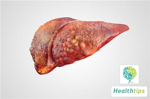 What Are the Available Treatment Methods for Liver Diseases?