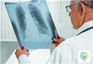 What Are the Characteristic Pathological Features of Tuberculosis?