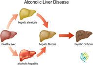 How Does Traditional Chinese Medicine Treat Liver Diseases?