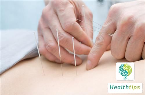 How Long Should Needles Be Retained for Acupuncture?