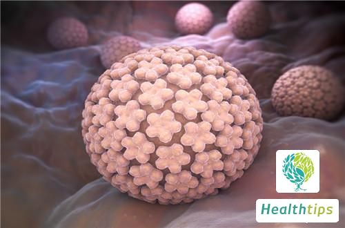 What Does a Positive HPV 58 Result Mean? What Are the Associated Symptoms?