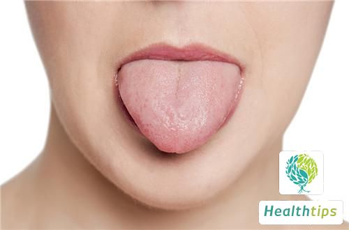 What Causes a Black Tongue and How Should It Be Managed?