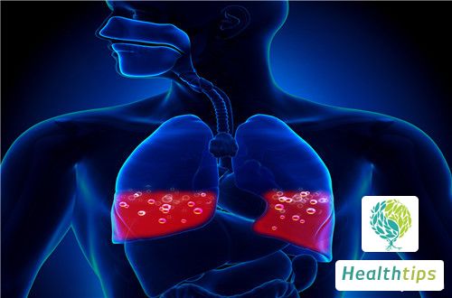 What Are the Causes of Right Lung Space-occupying Lesions? Whats Going On?