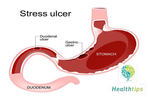 How to Distinguish between Stomach Heat and Stomach Cold?