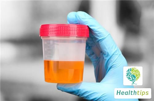 What Are the Differences Between Hematuria and Proteinuria?