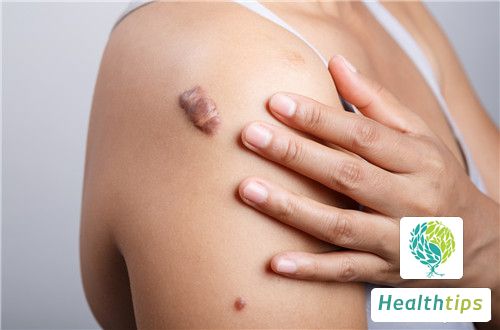 What Could Be the Cause of a Hard Lump Under the Skin?