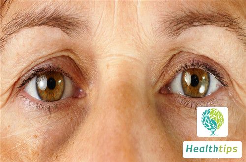 What Causes Redness in the Upper and Lower Eyelids? How Does It Happen?