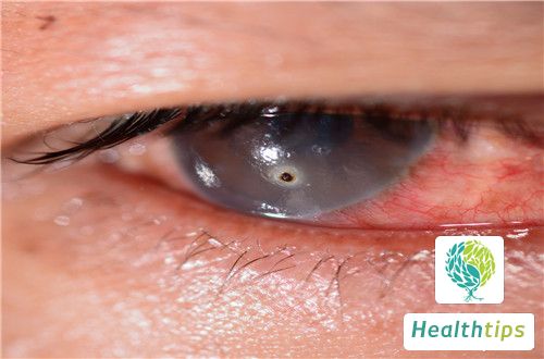 Why Do Elderly Peoples Eyes Tend to Tear Frequently?