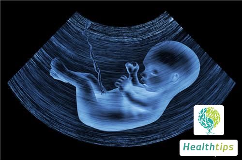 What Are the Main Components Examined in a Systematic Color Doppler Ultrasound Scan?