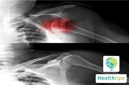 Where is the Thyroid Cartilage Located?