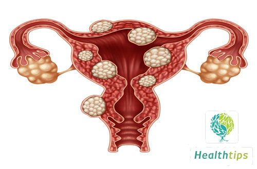 What does a normal cervix look like?