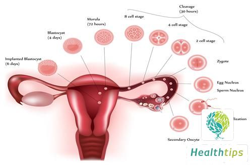 What Are the Symptoms of Ovarian Issues, and How Are They Treated?