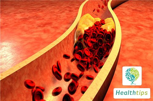 What is the Normal Range for Whole Blood Viscosity?