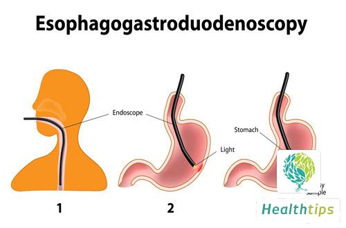 What Does a Full Gastrointestinal Barium Meal Examine?