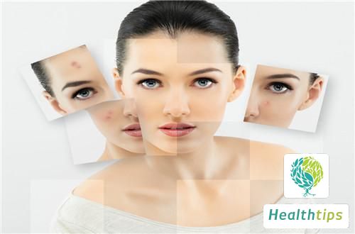 How to Improve Hormonal Skin Issues?