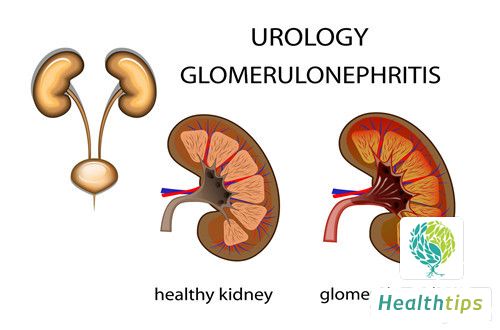 What Does GFR Mean?