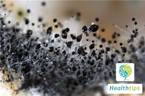 How to Treat Fungal Infections of the Scalp?