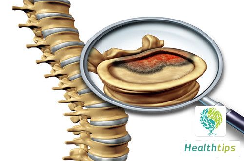 How to Deal with Spinal Tenderness?