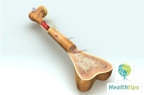 How to Treat Spinal Stenosis?