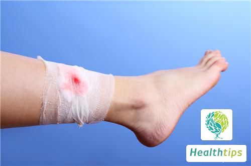 What Should I Do If a Wound Becomes Infected or Starts to Rot?