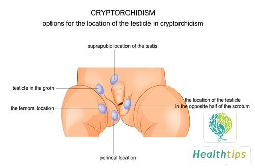 Why Do My Testicles Feel Unusually Cold?