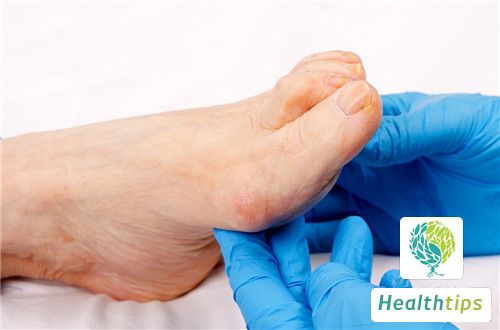 How to Handle Swollen Feet in Elderly People?