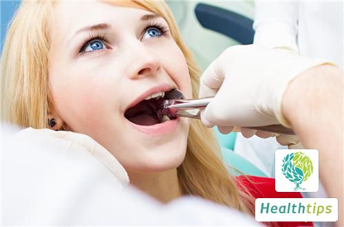 What Are the Symptoms and Treatments for Nerve Injury Caused by Wisdom Tooth Extraction?