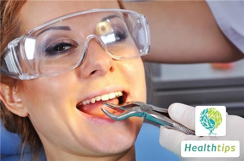 Where is the anesthesia applied for tooth extraction?