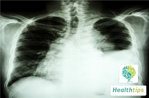 How much does a chest X-ray examination cost?