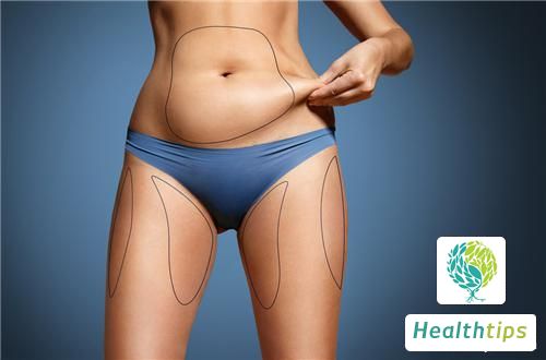 Is Liposuction a High-Risk Procedure?