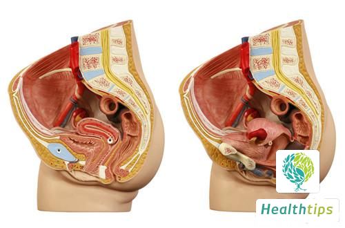 How to Physically Reduce the Sensitivity of the Glans Penis?