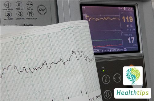 What is the Normal Range for RESP on a Heart Monitor?