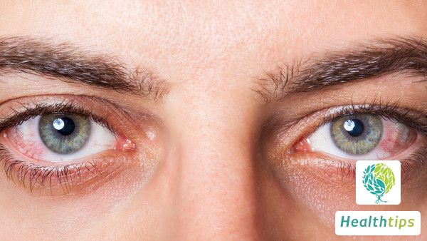 Can astigmatism in the eyes be cured?