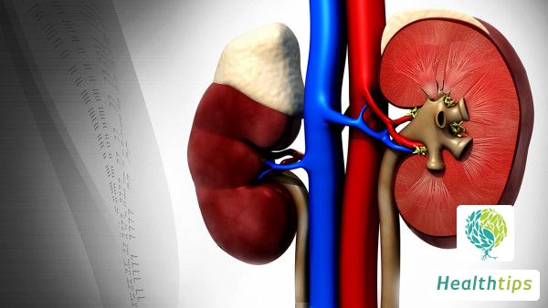 Where is the typical pain location for kidney stones?