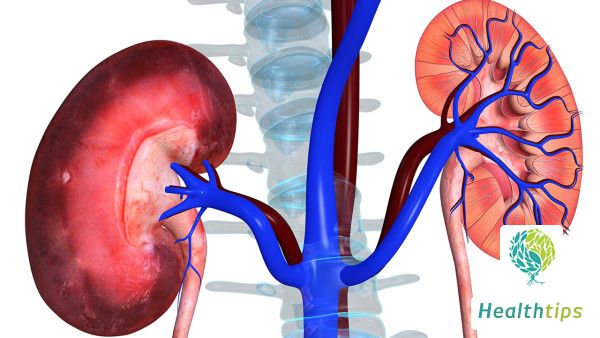 Is hospitalization necessary for kidney hydronephrosis?