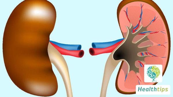 How to Treat Kidney Stone with Blood in Urine?