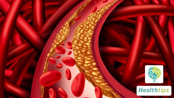 Can anemia be detected through a routine blood test?